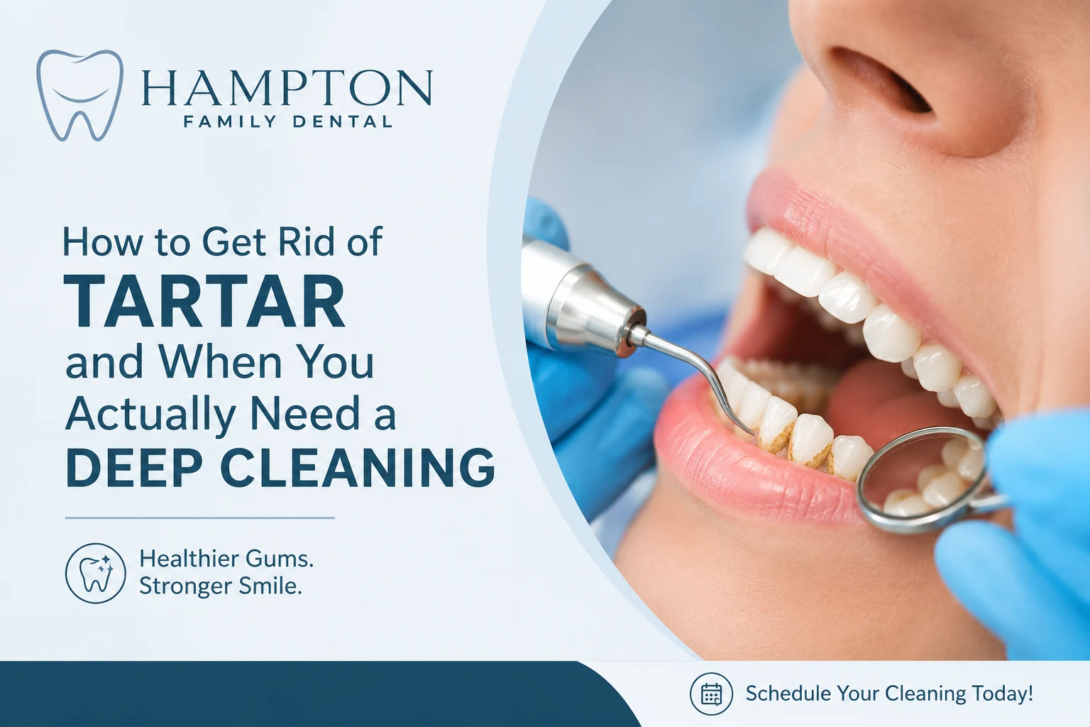 A hygienist removing tartar during a professional cleaning at Hampton Family Dental in Southampton PA