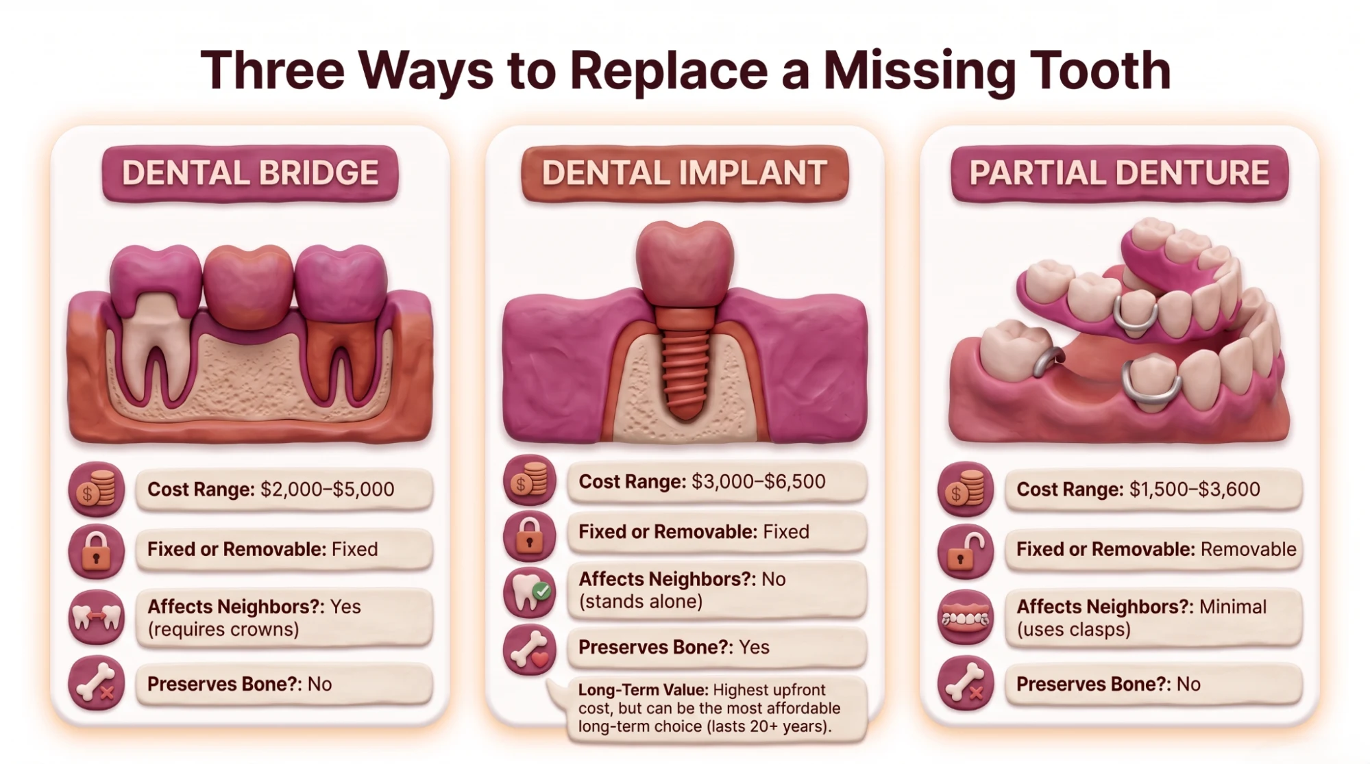 Three-panel diagram comparing ways to replace a missing tooth — a bridge anchored to two neighboring teeth, a single implant with a crown standing alone, and a removable partial denture.
