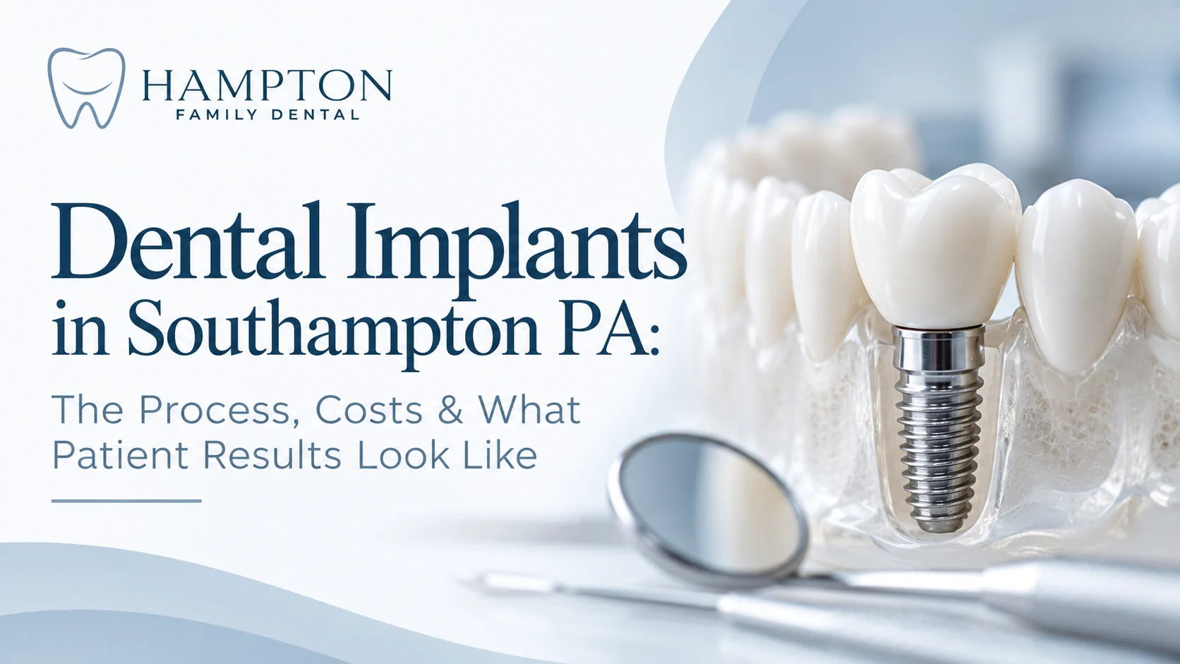 The dental implant process at Hampton Family Dental in Southampton PA — process, costs and what patient results look like