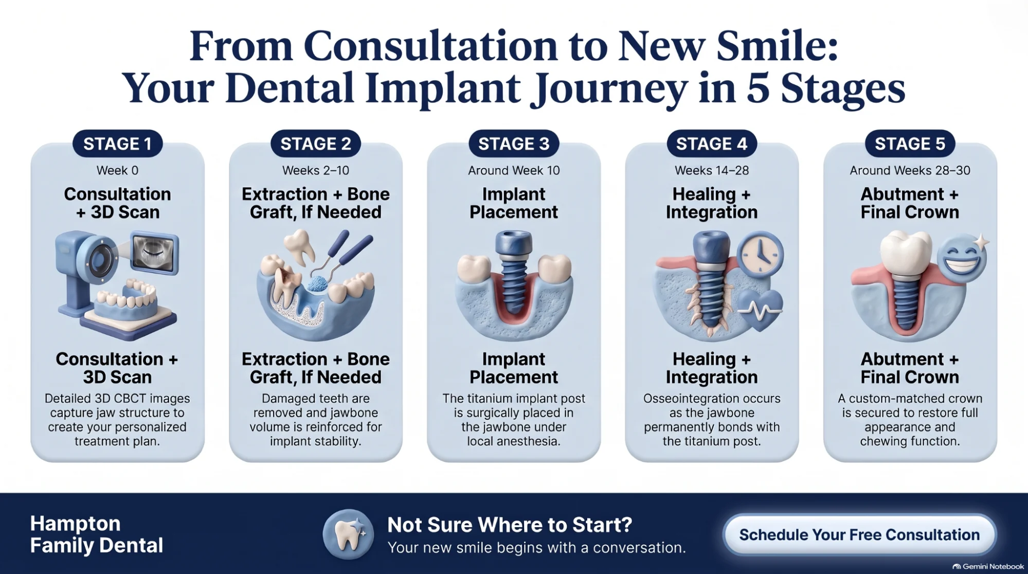 Infographic titled From Consultation to New Smile showing the five stages of a dental implant journey with icons and week ranges for each stage.