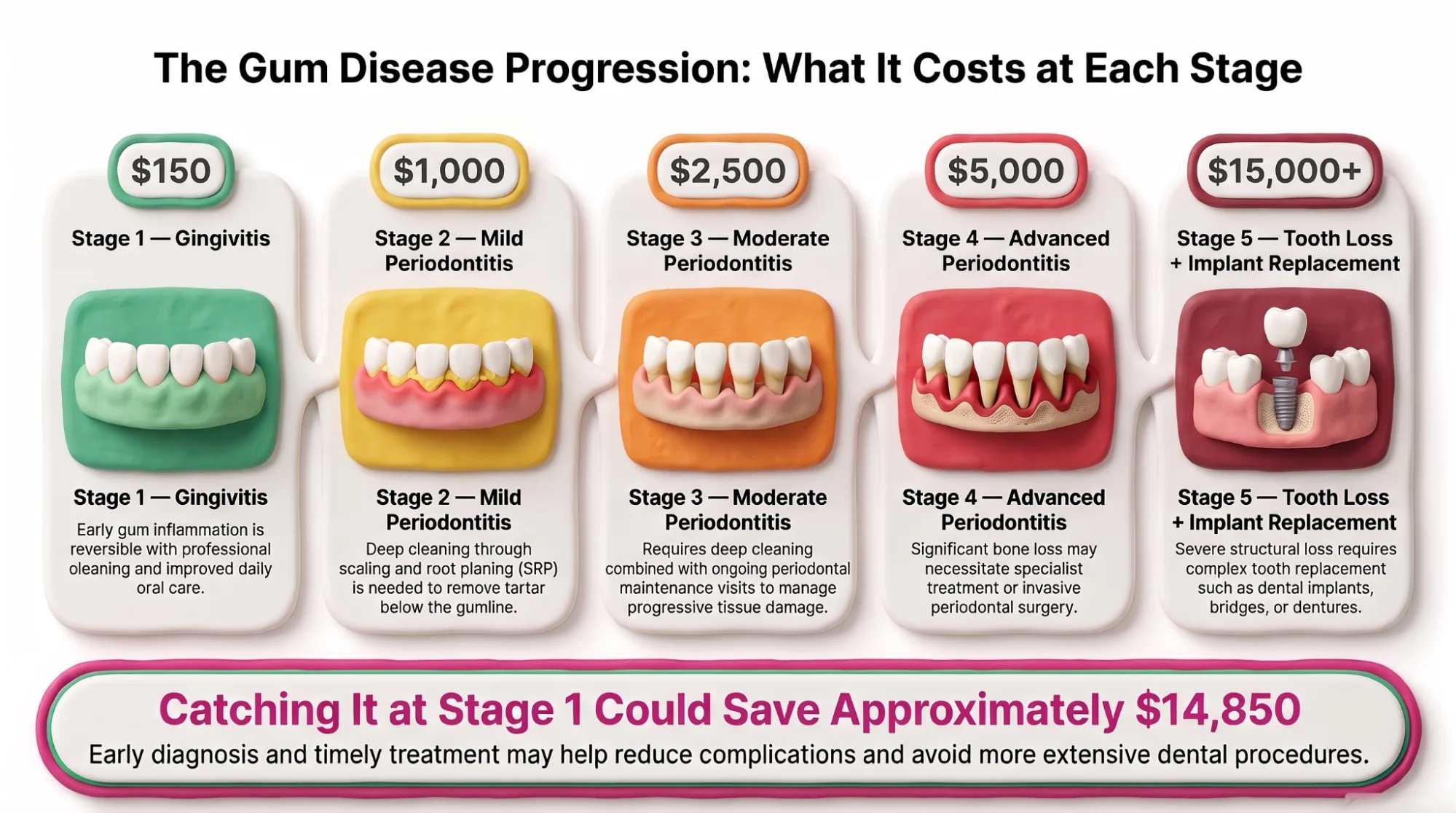 Infographic of the five-stage gum disease progression with the cost at each stage, from reversible gingivitis through to tooth loss and implant replacement.
