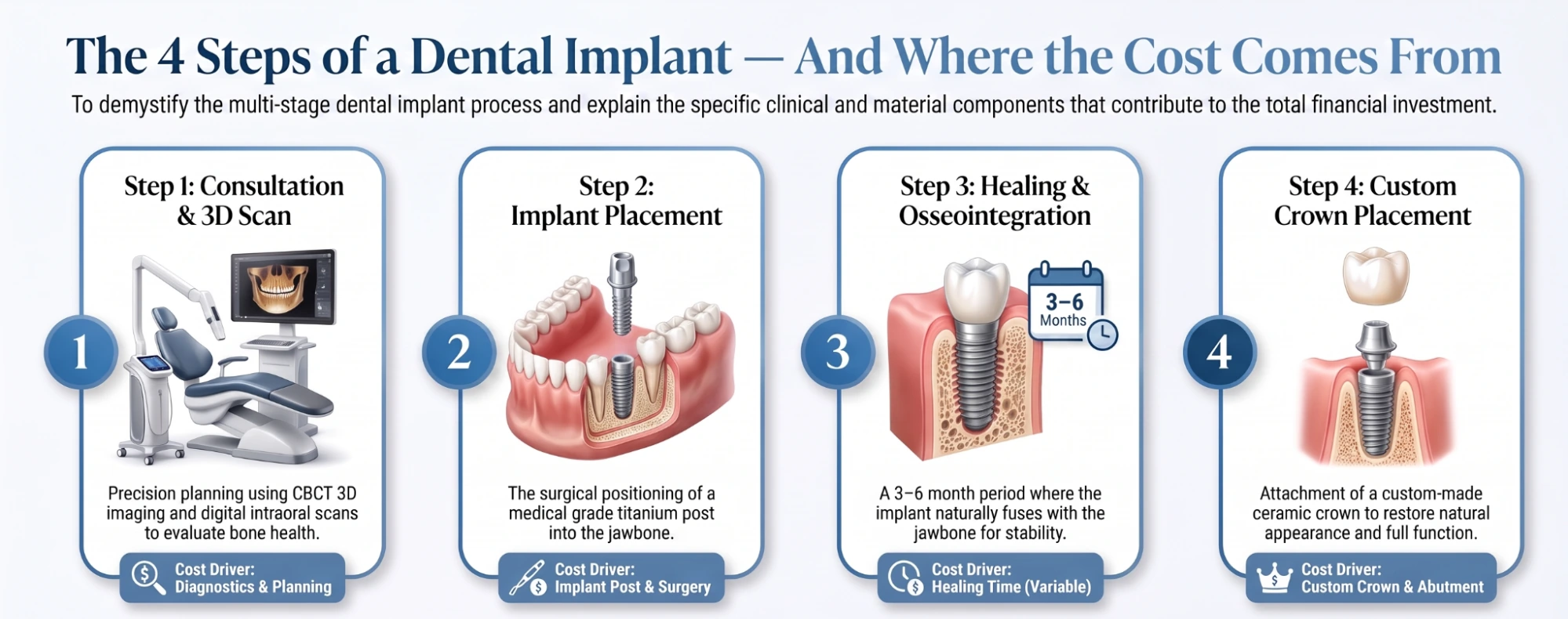 Infographic of the four steps of a dental implant — consultation and 3D scan, implant placement, healing and osseointegration, and custom crown placement — each tagged with the cost it drives.