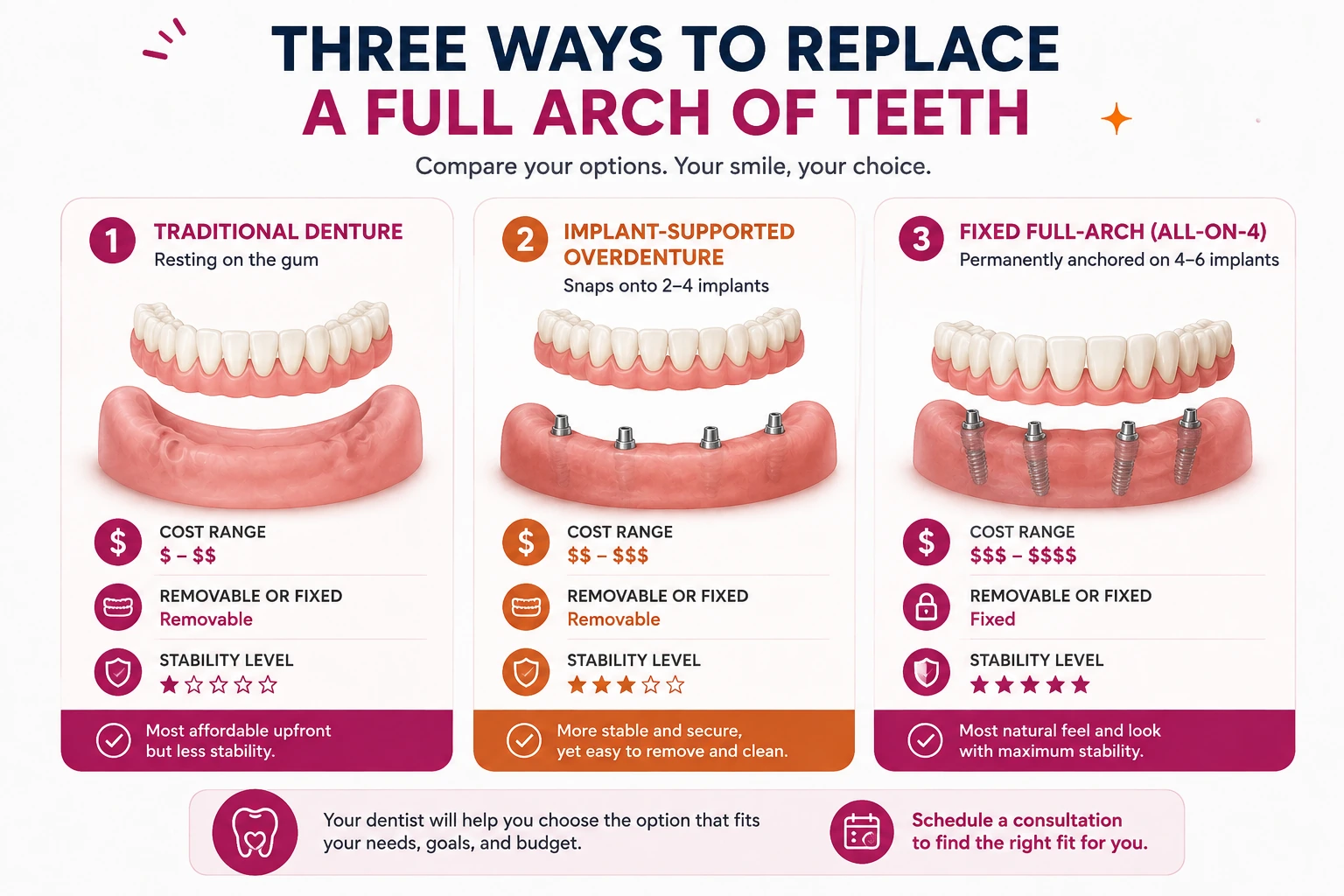 Three ways to replace a full arch of teeth compared — a traditional denture resting on the gum (removable, lowest cost, least stable), an implant-supported overdenture snapping onto 2–4 implants (removable, mid cost, more stable), and a fixed full-arch All-on-4 permanently anchored on 4–6 implants (fixed, highest cost, most stable).