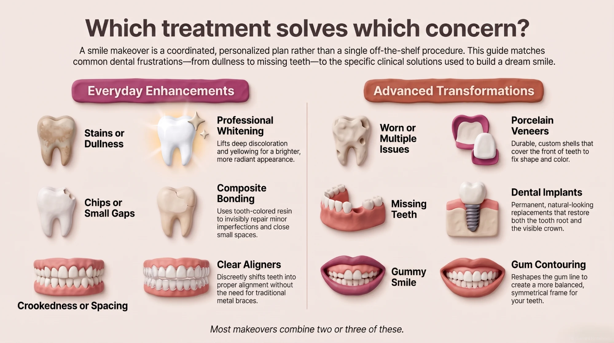 Overview of treatments a smile makeover can include — whitening, bonding, clear aligners, porcelain veneers, dental implants, and gum contouring.